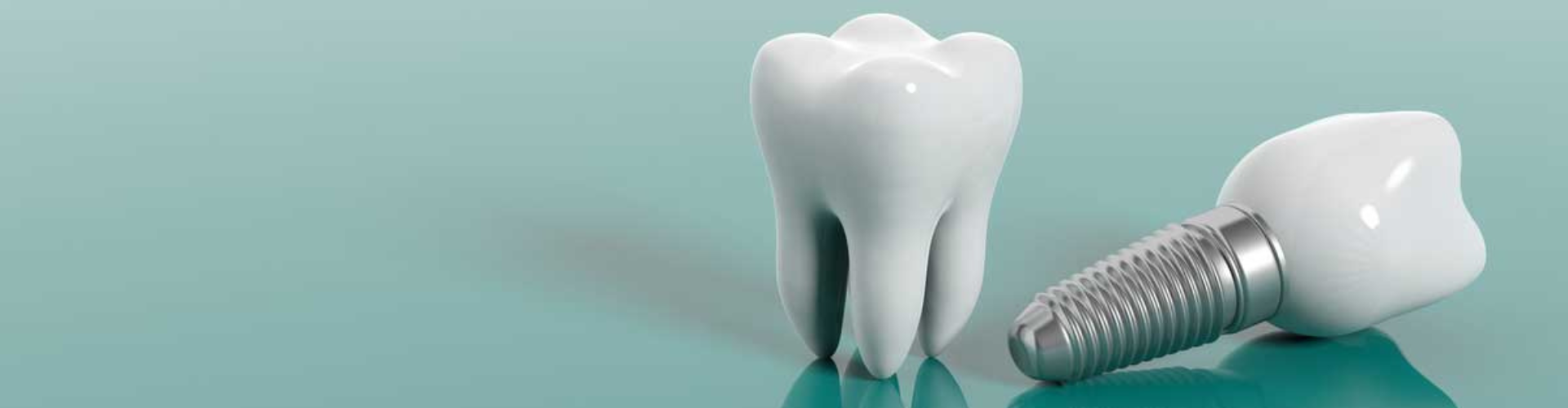 3D render of a tooth and a dental implant.